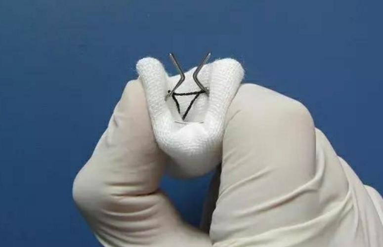 包茎扩张器,可以实现逐步,持续,温和扩张松弛包皮口的发明.