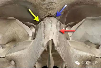 下图:鼻额缝(蓝箭),鼻上颌缝(红箭),额颌缝(黄箭)鼻骨孔:鼻骨的中间有