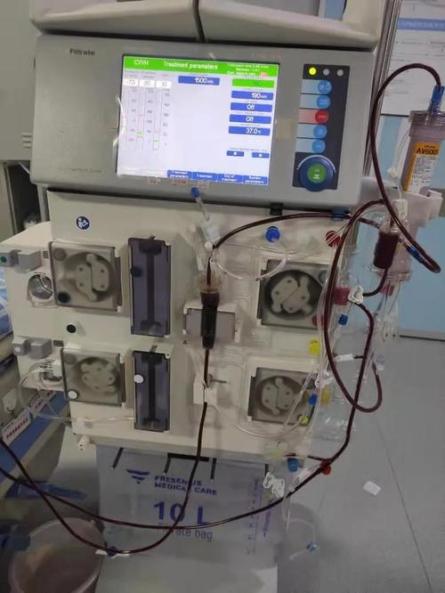 耿马县人民医院成功开展crrt新技术