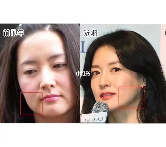 明星发腮脸大合集_发腮_赫本_法令纹_文案_张曼玉_保养_娱乐_明星娱乐