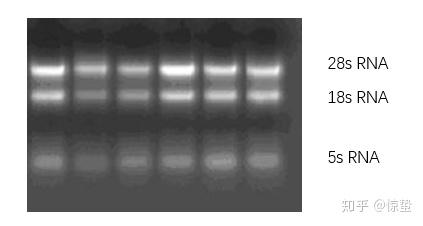 1 完整性良好的rna胶图下面就常出现的几种rna的结果图为大家分析一下