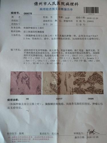 术后病理结果提示胸腺鳞状细胞癌.