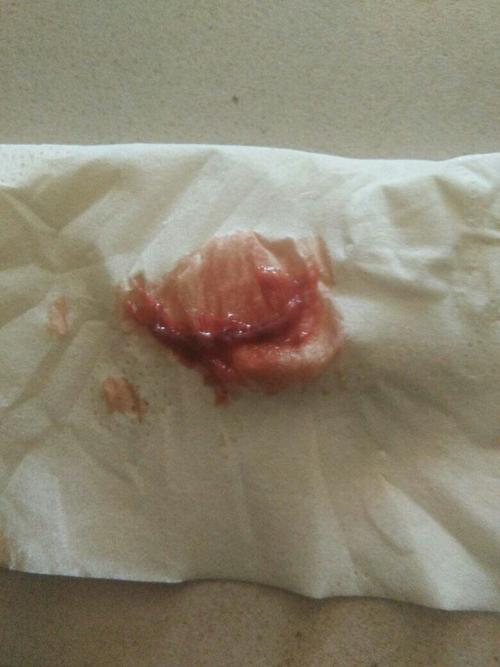 以前月经来4天现在只来2天到3天并且量很少