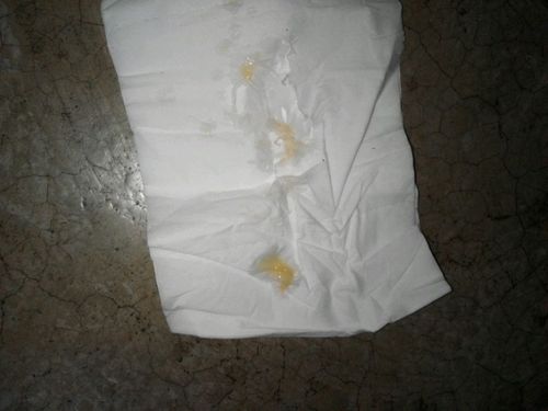 这是我亲自用～papa第二天排出的垃圾