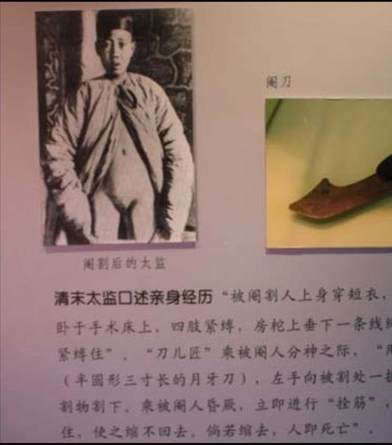 太监是中国独有的么?