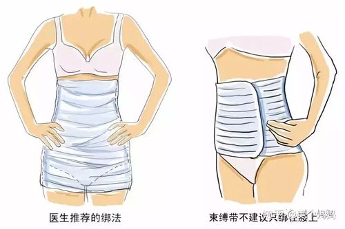 产后腹直肌分离那些事儿之"两"做"五"不做