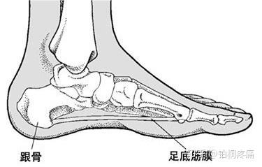 足底筋膜炎症状 早晨起床或静止一段时间后的第一步足跟及足心疼痛