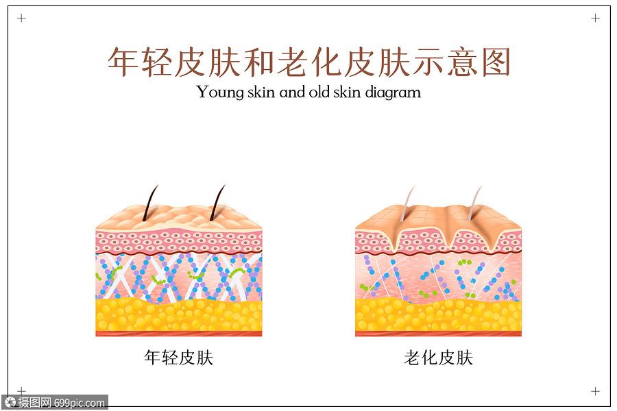 年轻皮肤和老化皮肤示意图