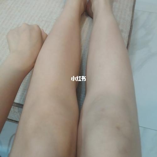 腿部美白3_美白_卡尼尔怎么样_身体护理_身体护理分享