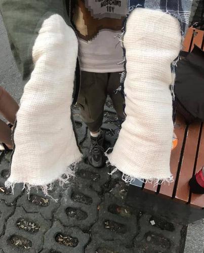 王一博粉丝get同款被说打了石膏?滑板莫名背锅,胳膊"骨折"