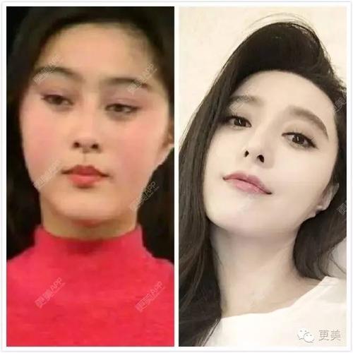 外翻的鼻翼修饰掉,圆形的鼻孔也升级成水滴形,鼻子给范冰冰的女王气势