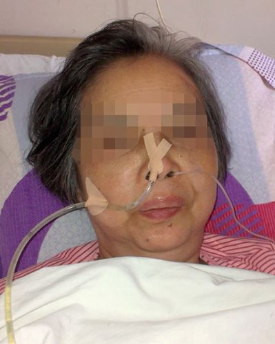 胃管改良固定法在胸心外科推广应用