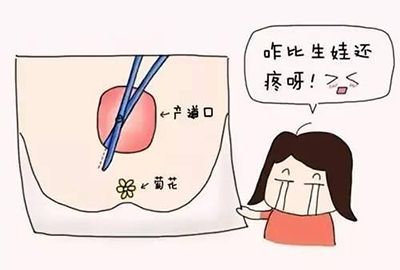 顺产的孕妈侧切是必须的吗?十个产妇九个切,什么情况下会使用侧切呢?