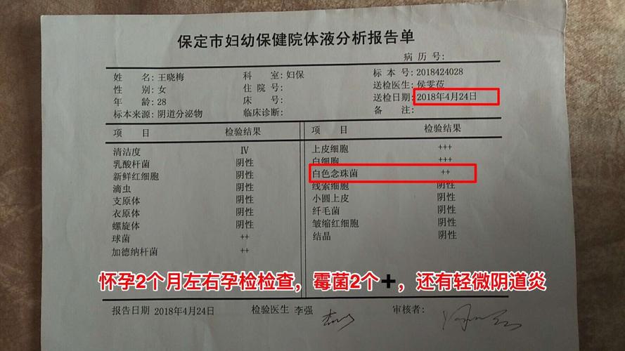 外阴阴道假丝酵母菌病(霉菌性阴道炎)