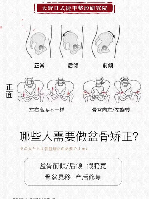 骨盆修复_骨盆_产后妈妈_母婴_妈妈经验
