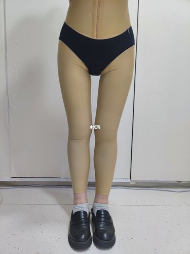 大腿环吸第三天,更肿了00_大腿环吸_新街口自由行热门攻略_果冻