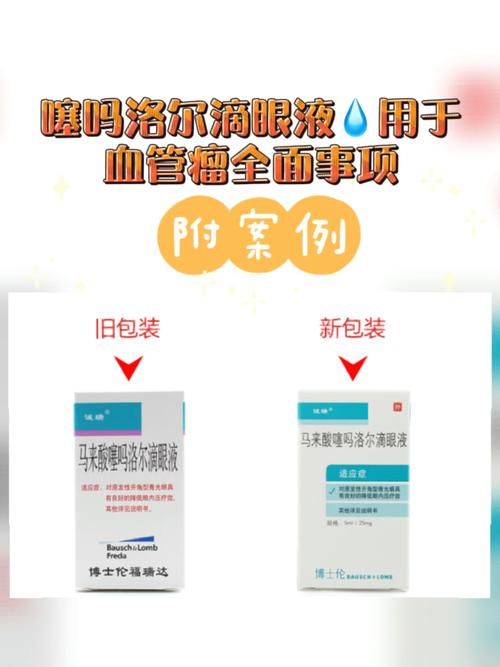 99噻吗洛尔滴眼液用于血管瘤全面分享_血管瘤_眼药水_婴幼儿_过敏