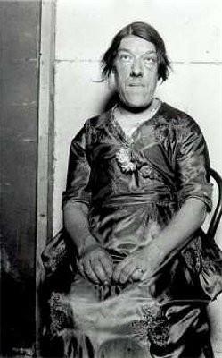 最恐怖的22个怪胎图片