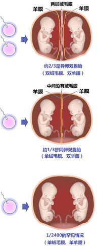 胎囊,但两者间血液循环并不相通,胎囊之间的中隔由两层羊膜及两层绒毛
