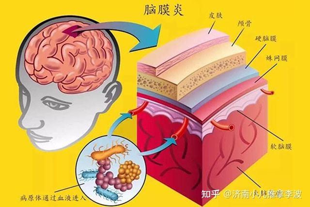 10%～20%的幸存者遗留各种神经系统严重后遗症,常见的神经系统后遗症