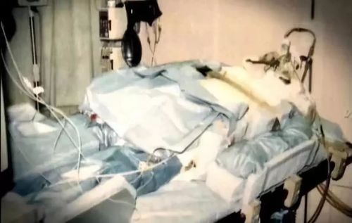 83天活体腐烂!——被核辐射才是最痛苦的死亡方式!