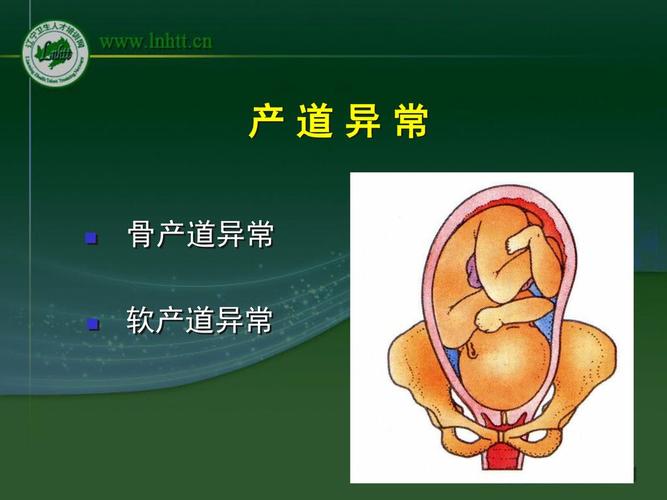 产道异常 中国医科大学盛京医院 魏军.