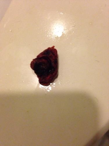 排序|2条回答  2013-09-02 12:42 |十三级 从胎儿的角度看人工流产,那