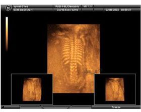 肋骨串珠是由于缺钙造成的肋软骨发育不良的结果.···详情