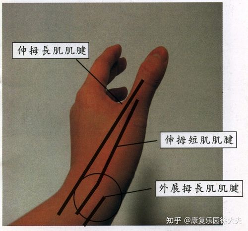 图一伸拇短肌及外展拇长肌肌腱的解剖位置 图二,肌腱的纵切面 二