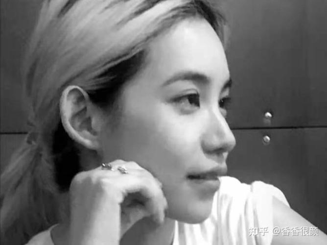 颧骨高会影响侧脸颜值吗?