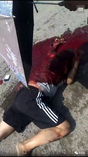 今天上午,扬州这个地方发生惨烈车祸,血肉模糊!受伤男子抢救无效死亡.