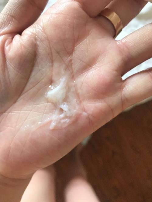 求妇科医生看看这个白带是不是不正常?