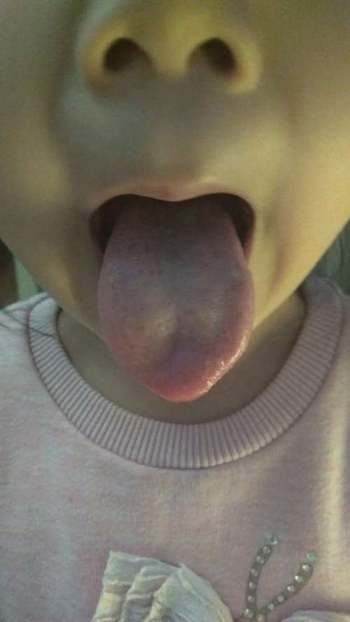 舌苔