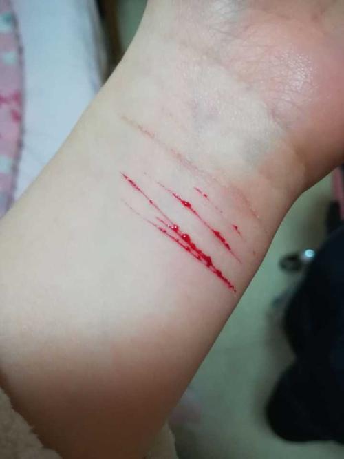 在面对无法承受的痛苦时自残会让我觉得好受点划伤自己就又有勇气