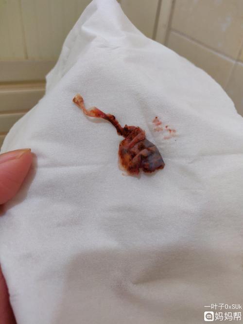 今天月经第二天起来发现像皮一样的东西