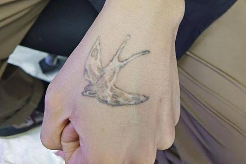 因好奇尝试纹身,造成了疤痕增生,高中生纹身遇到麻烦事