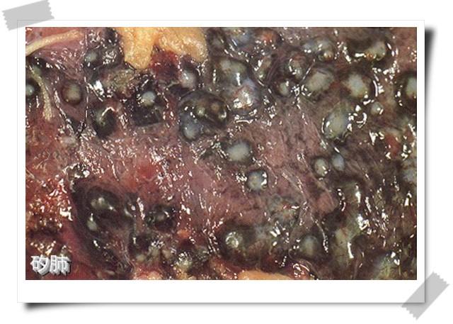 矽肺病因是什么?