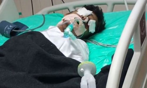 印度医院发生恶性事件!icu病人在病房昏迷,老鼠爬上脸