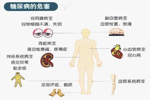 为什么糖尿病容易引起血管并发症高血糖触发的蛋白可能是关键