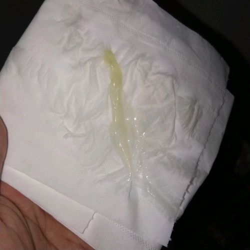 这白带真是吓到我