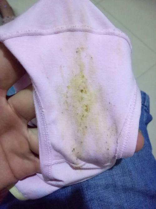 我的女儿7岁了 今年发现 内裤有分泌物 以前有的黄现在有的绿了 怎么