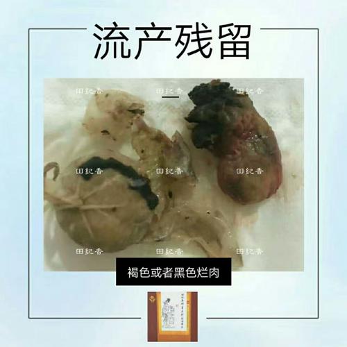 是像水,像鼻涕一样的粘稠的 糜烂:圆子发褐色,特别黄,有血或血丝 霉菌
