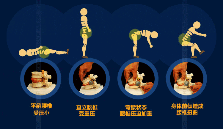 许多人得了腰椎间盘突出症后询问医生,用中医的方法,例如推拿复位