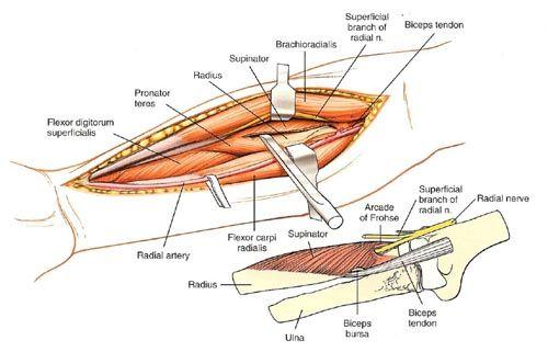 百度见贤思齐 文件夹1  桡骨前侧入路的适应症 桡骨骨折切开复位内