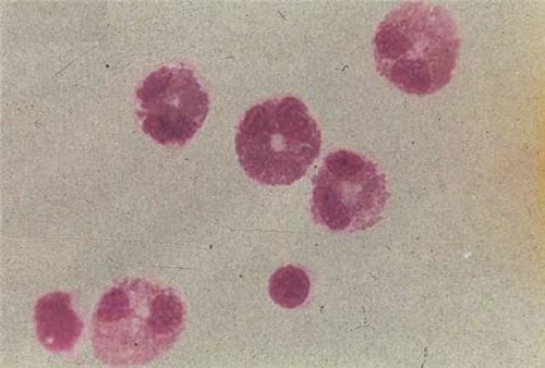 嗜酸性粒细胞具有杀伤细菌,寄生虫的功能,也是 a target="_blank"