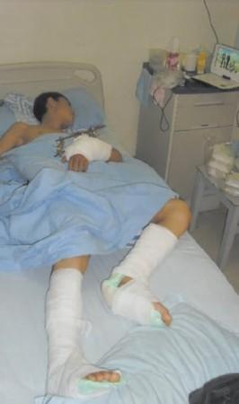 当事学生多处骨折,事发前曾与老师在课堂上发生争执,目前已被送到医院