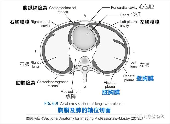 肋膈隐窝(costodiaphragmaticrecesses):肋胸膜与膈胸膜返折形成的半