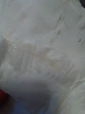 今天上厕所发现有些像白带的东西,但是是透明的.