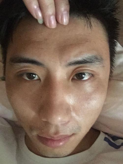 求大神指点,我这个额头凹陷,面部结构,是不是苦命啊