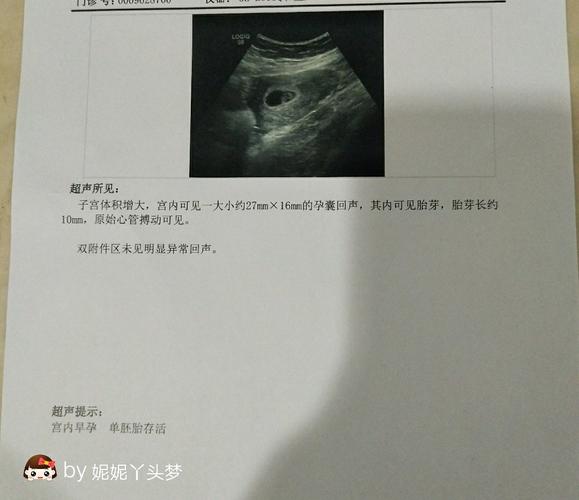 35天照的接宝宝回家过年了